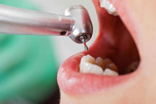 Best Emergency Treatment for Dental Infections or Abscesses in Hendersonville, NC